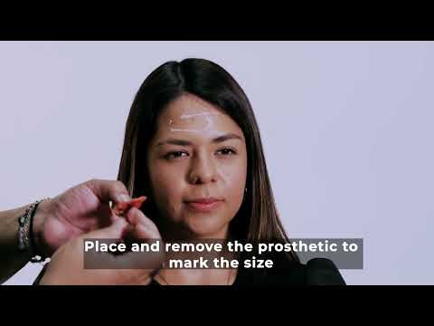 Fausse plaie avec points de suture