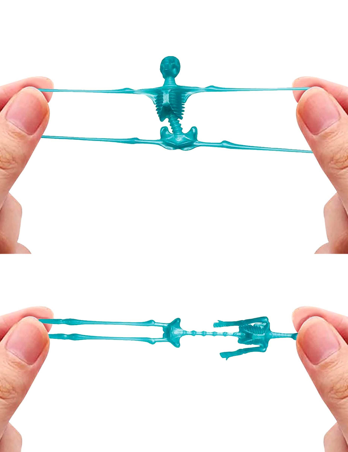 Schelete elastice 10 cm